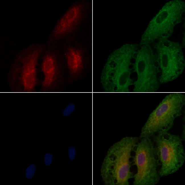 BST-1 Antibody in Immunocytochemistry (ICC/IF)