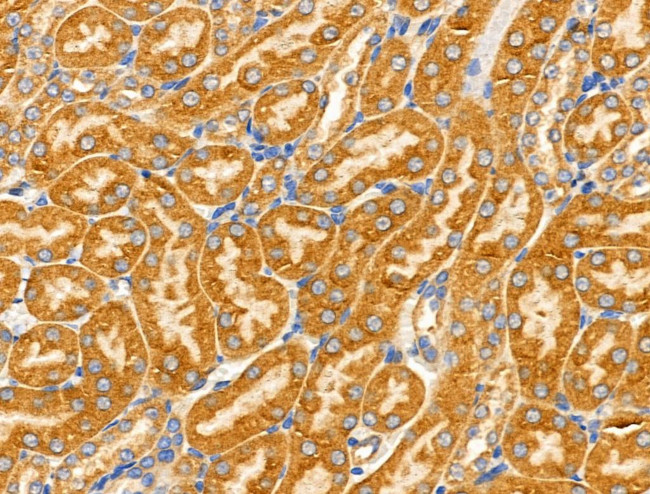 AKR1E2 Antibody in Immunohistochemistry (Paraffin) (IHC (P))