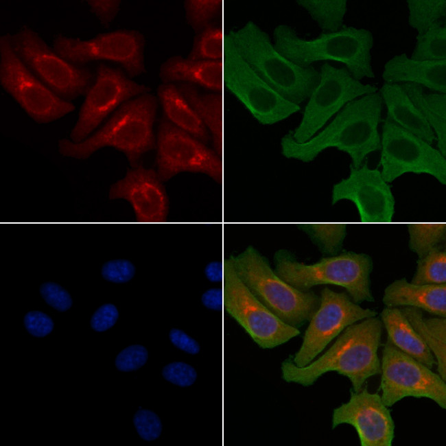 Arylsulfatase E Antibody in Immunocytochemistry (ICC/IF)