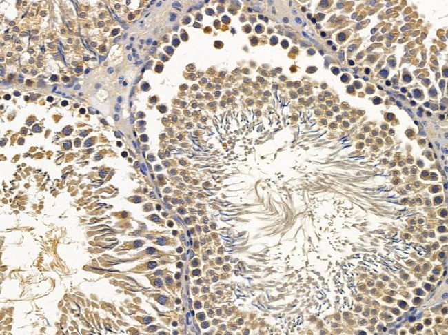 Arylsulfatase E Antibody in Immunohistochemistry (Paraffin) (IHC (P))