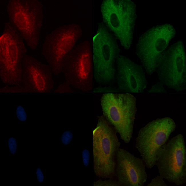 ATXN2L Antibody in Immunocytochemistry (ICC/IF)