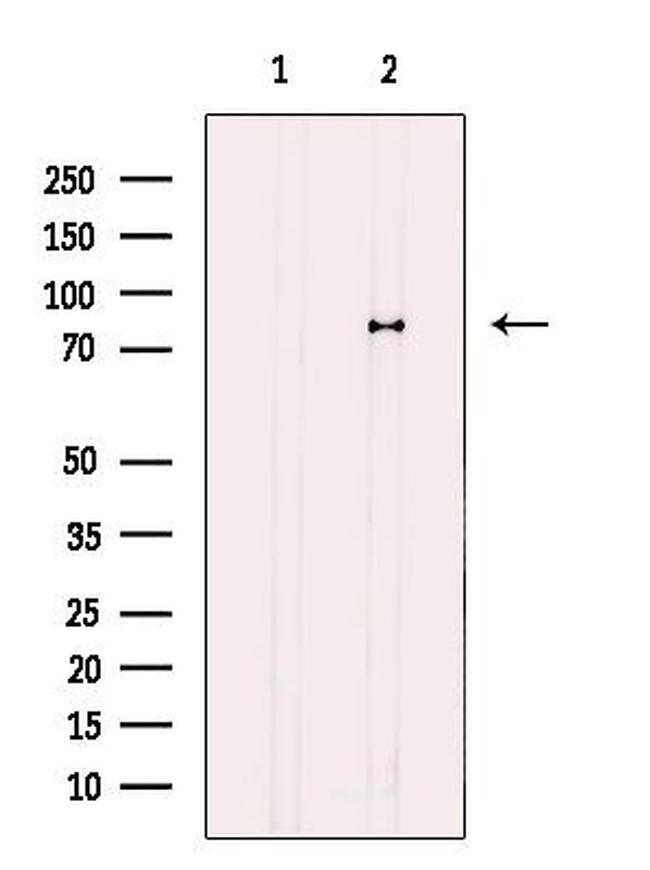 ATXN7L2 Antibody in Western Blot (WB)