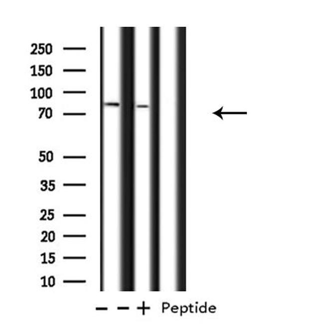 ATXN7L2 Antibody in Western Blot (WB)