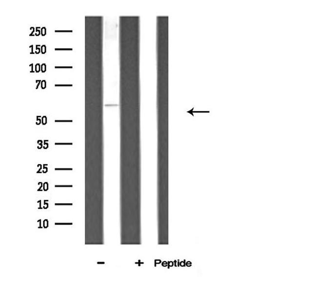 ATP5A1 Antibody in Western Blot (WB)