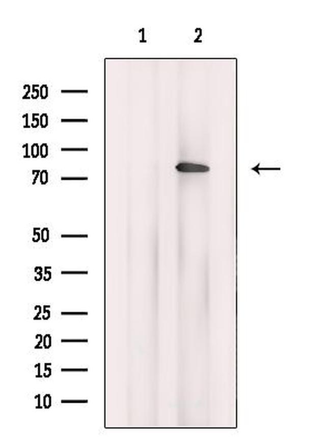 DDX50 Antibody in Western Blot (WB)