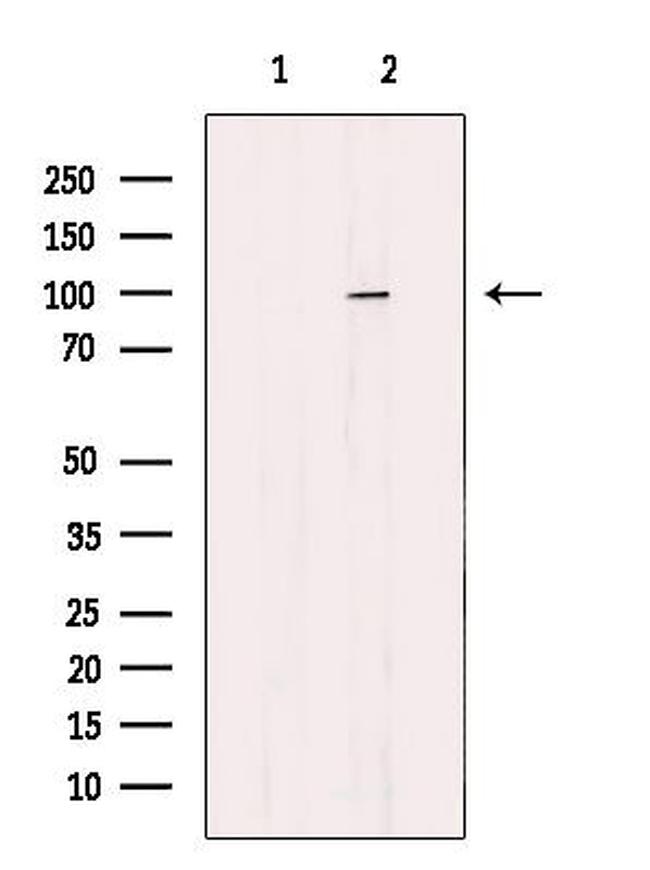 DDX54 Antibody in Western Blot (WB)