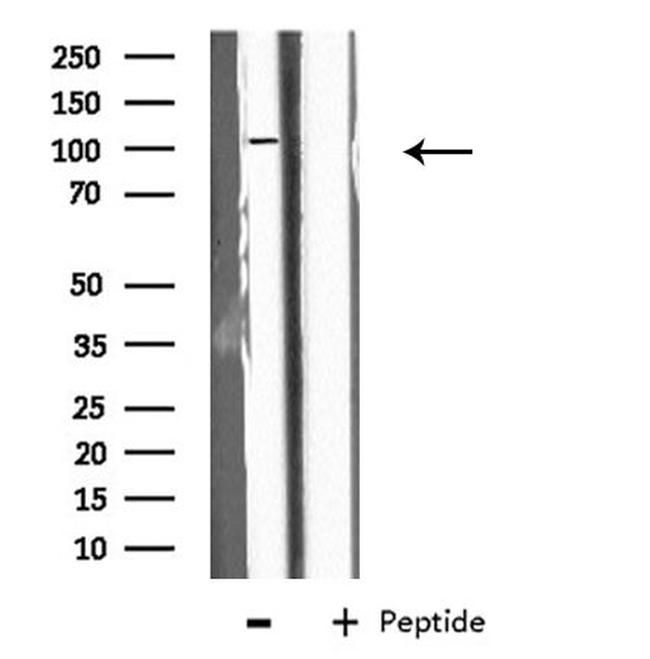 EPB41L2 Antibody in Western Blot (WB)