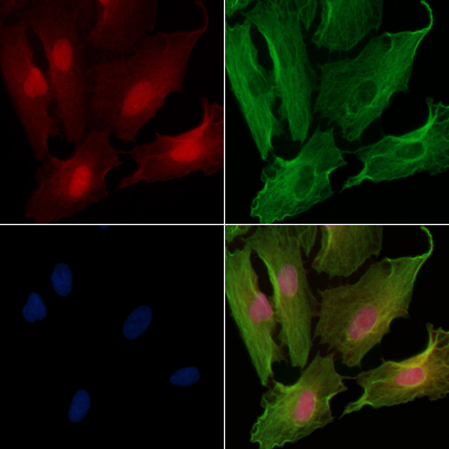 BOK Antibody in Immunocytochemistry (ICC/IF)