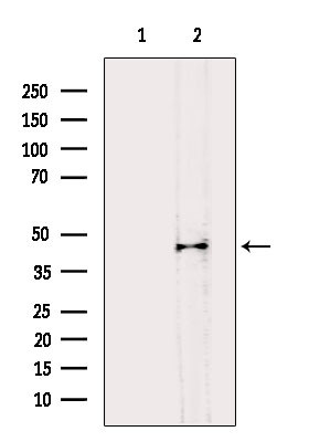 B4GALT1 Antibody in Western Blot (WB)