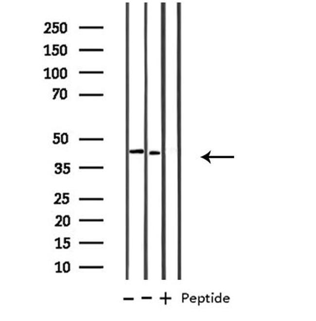 B4GALT1 Antibody in Western Blot (WB)