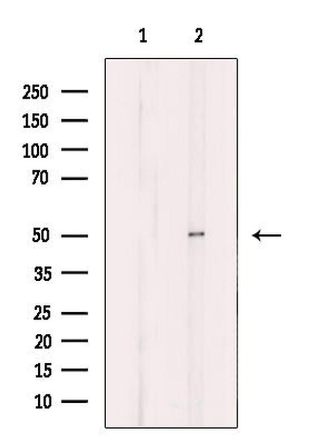 B4GALT3 Antibody in Western Blot (WB)