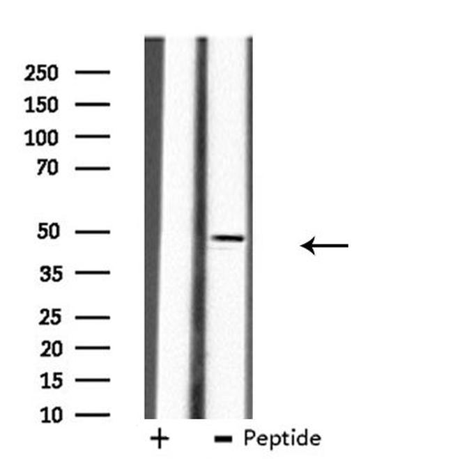 B4GALT3 Antibody in Western Blot (WB)