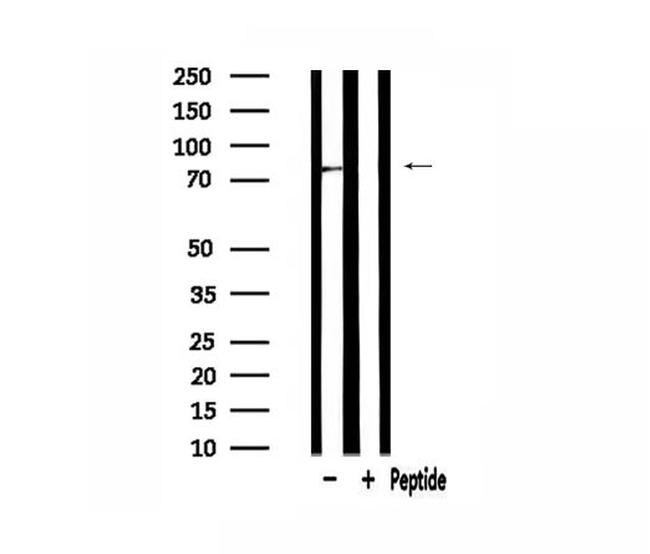 GUSB Antibody in Western Blot (WB)