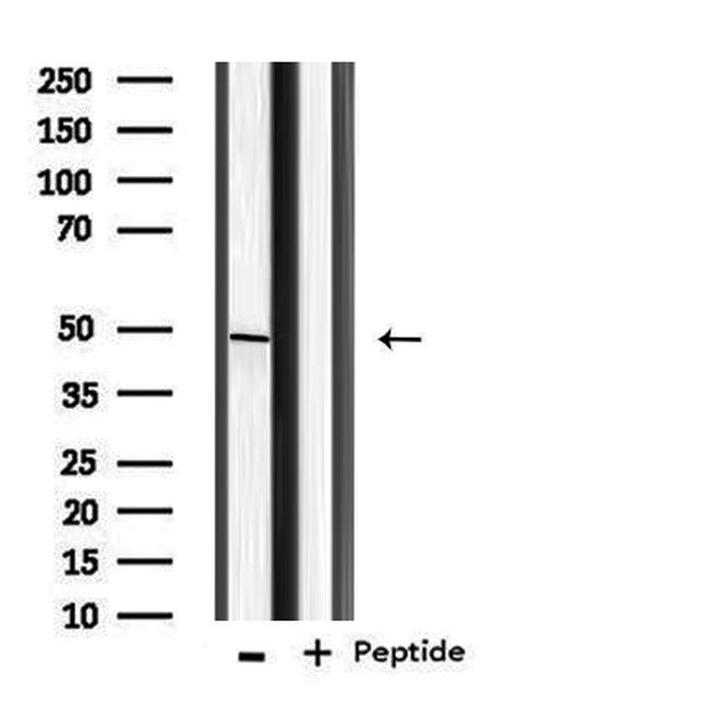 BMP-10 Antibody in Western Blot (WB)