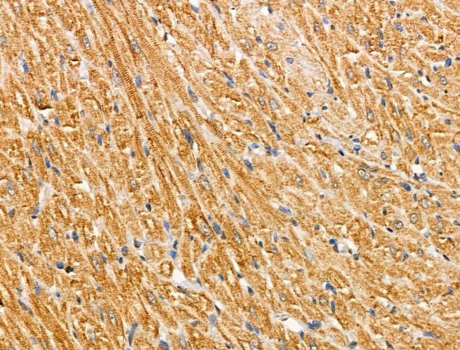 KCNMB2 Antibody in Immunohistochemistry (Paraffin) (IHC (P))