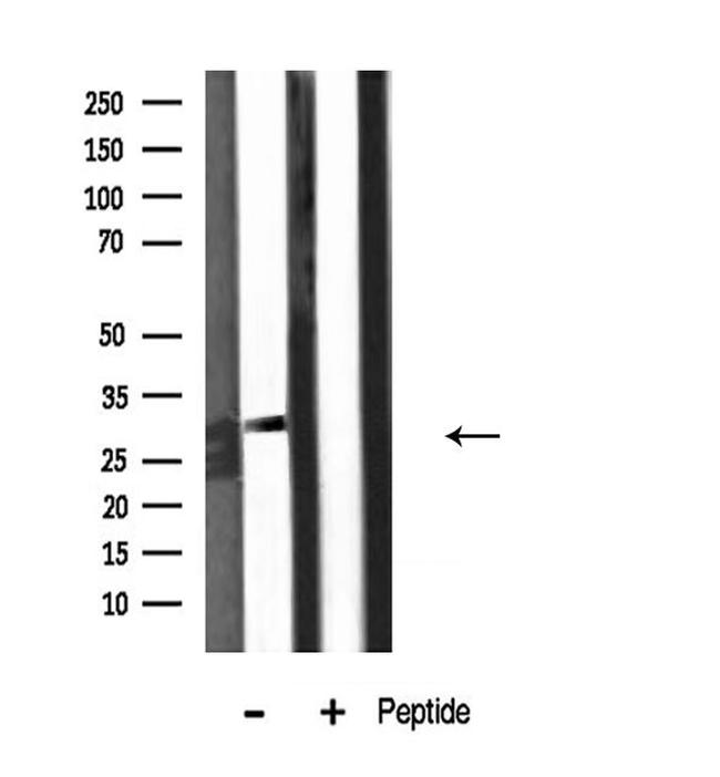 KCNMB2 Antibody in Western Blot (WB)