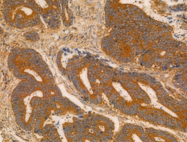 CHP1 Antibody in Immunohistochemistry (Paraffin) (IHC (P))