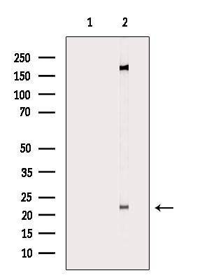 CHP1 Antibody in Western Blot (WB)