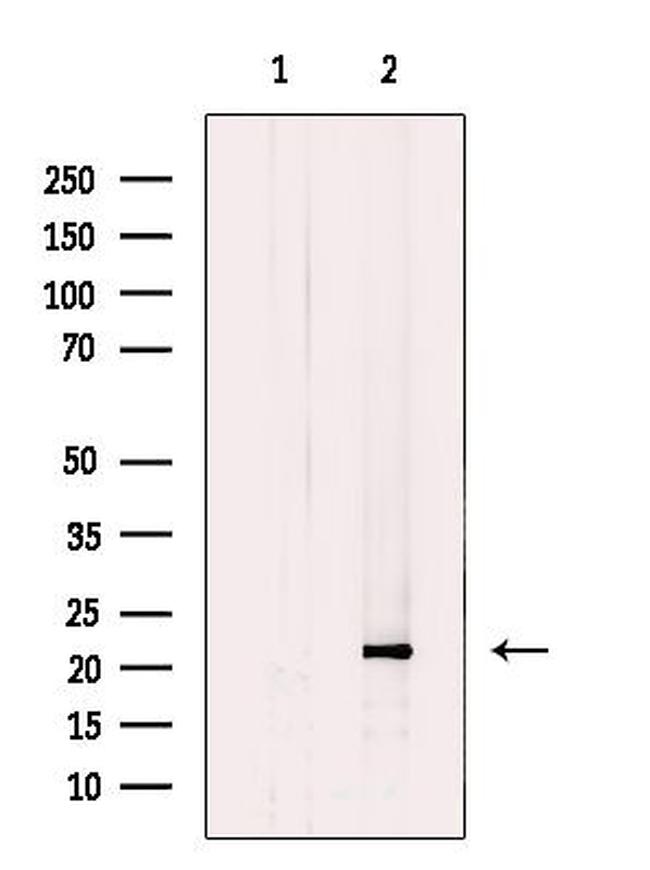 CHP1 Antibody in Western Blot (WB)