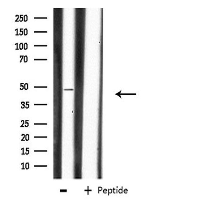 CHST1 Antibody in Western Blot (WB)