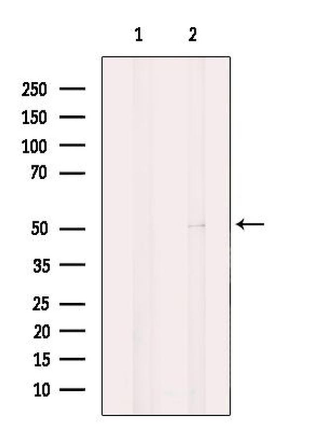 Carboxypeptidase M Antibody in Western Blot (WB)