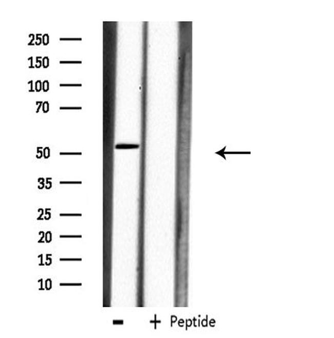 Carboxypeptidase M Antibody in Western Blot (WB)