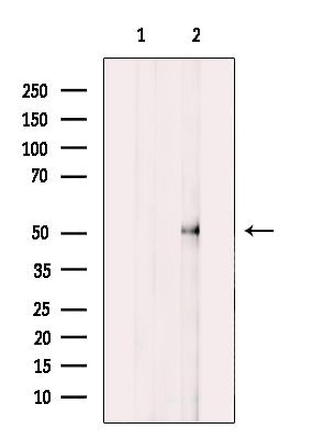 Cerebral Protein 1 Antibody in Western Blot (WB)