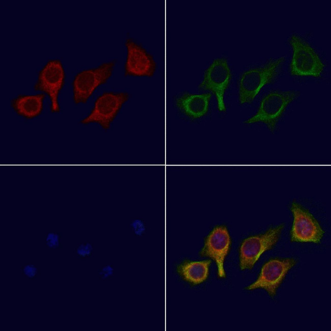 ATG4C Antibody in Immunocytochemistry (ICC/IF)