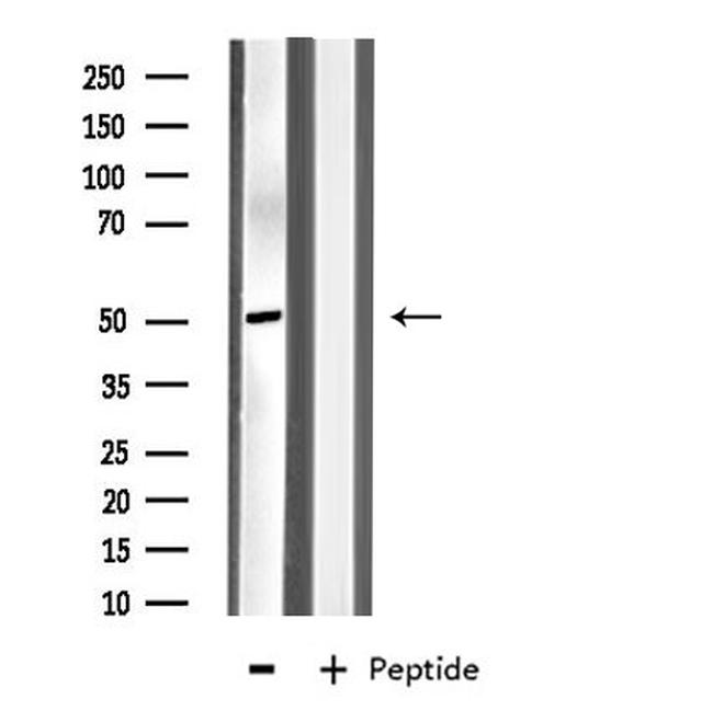 MYLIP Antibody in Western Blot (WB)