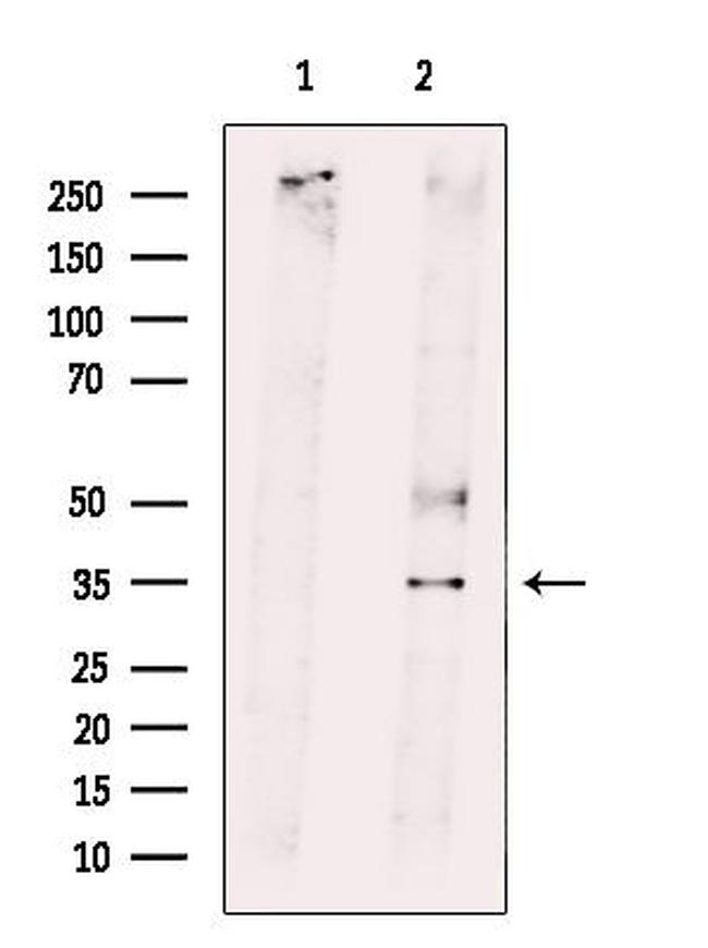 RNF144B Antibody in Western Blot (WB)