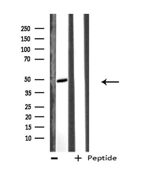 EFEMP2 Antibody in Western Blot (WB)