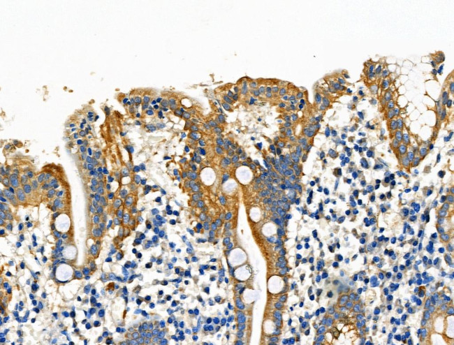 eIF5B Antibody in Immunohistochemistry (Paraffin) (IHC (P))