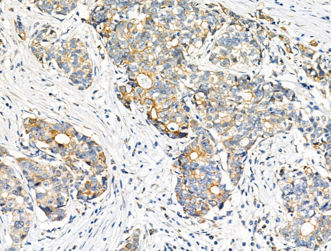 eIF5B Antibody in Immunohistochemistry (Paraffin) (IHC (P))