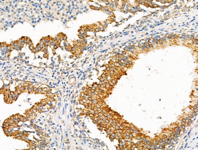 eIF5B Antibody in Immunohistochemistry (Paraffin) (IHC (P))