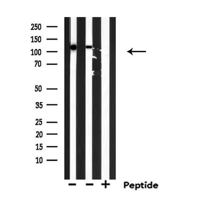 eIF5B Antibody in Western Blot (WB)