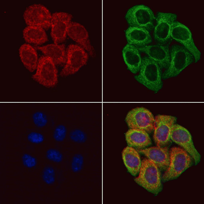 Fibulin 5 Antibody in Immunocytochemistry (ICC/IF)