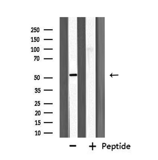 Fibulin 5 Antibody in Western Blot (WB)