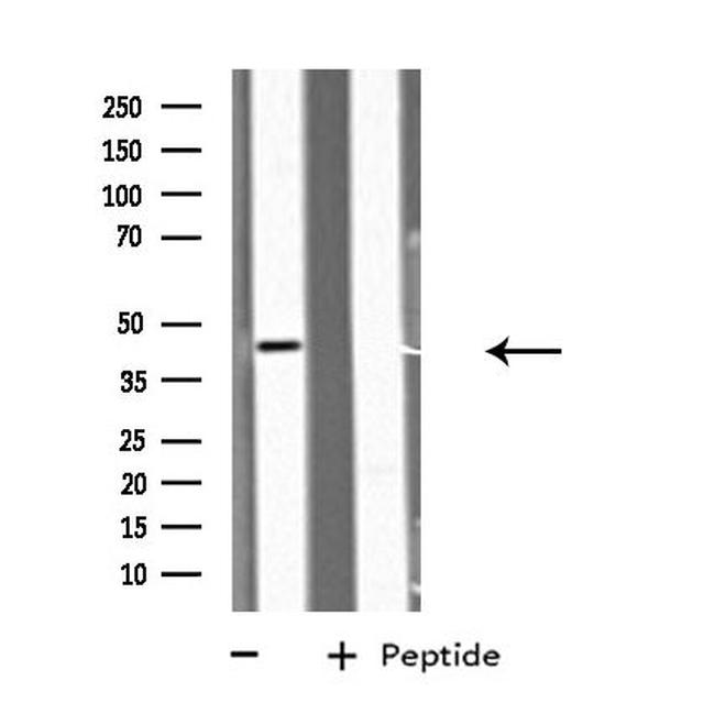 GDF7 Antibody in Western Blot (WB)