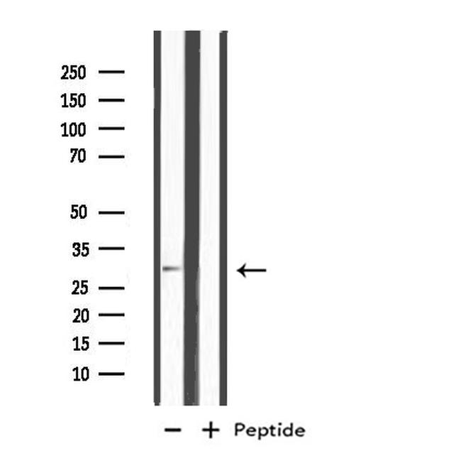 MSX2 Antibody in Western Blot (WB)