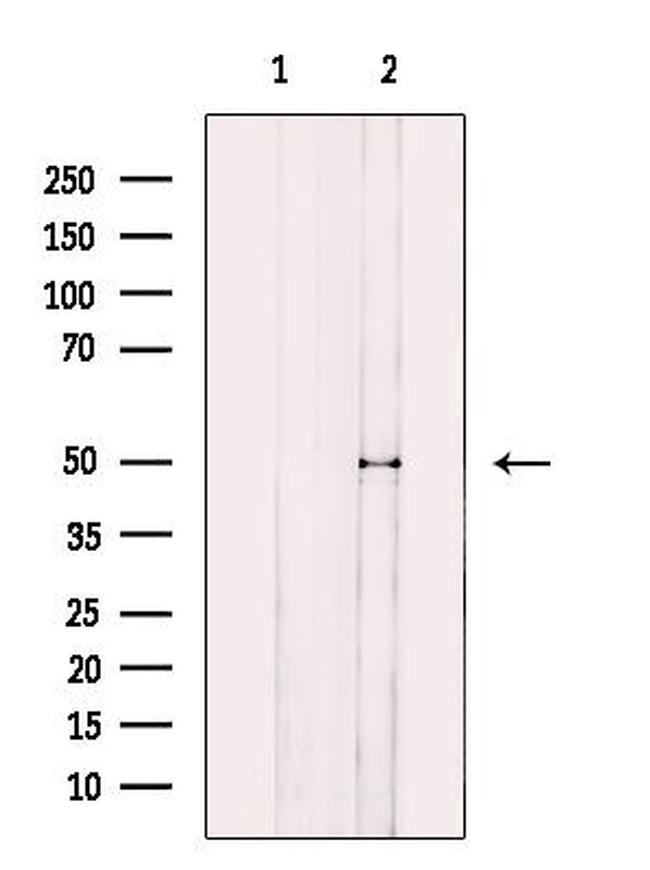 KCNN4 Antibody in Western Blot (WB)