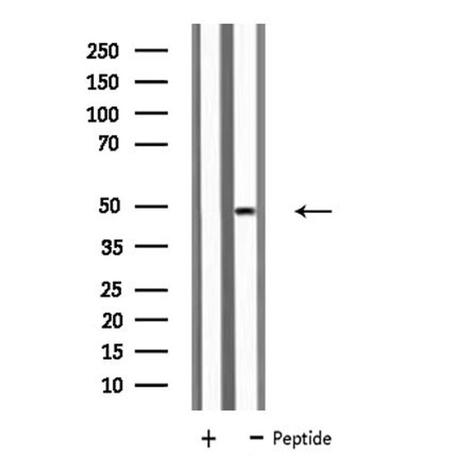 KCNN4 Antibody in Western Blot (WB)