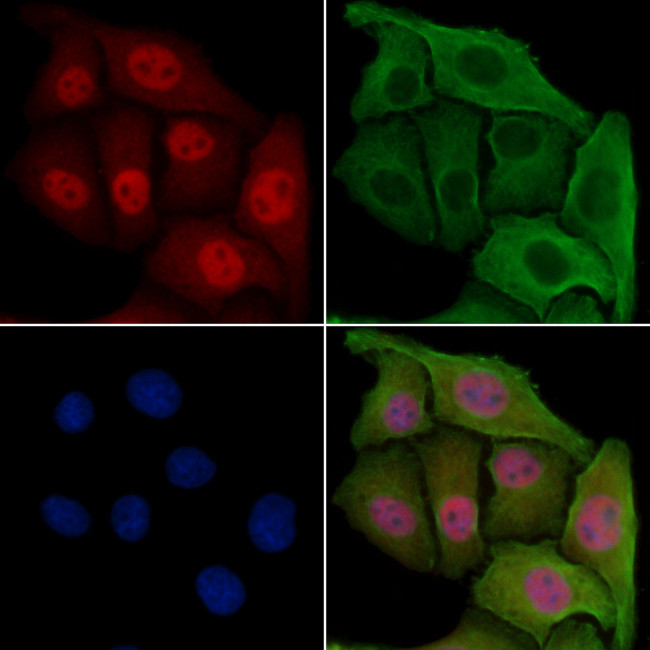 MAD2L1BP Antibody in Immunocytochemistry (ICC/IF)