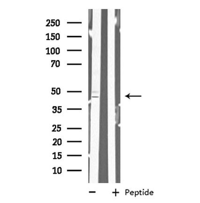 MAD2L1BP Antibody in Western Blot (WB)