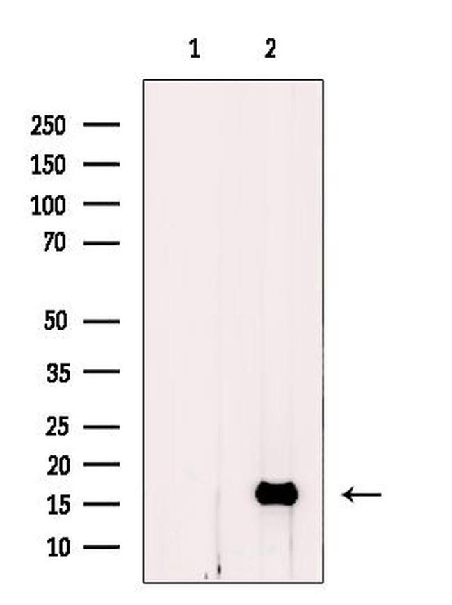 MGST2 Antibody in Western Blot (WB)