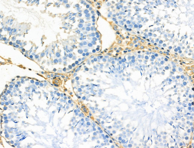 TOMM20 Antibody in Immunohistochemistry (Paraffin) (IHC (P))