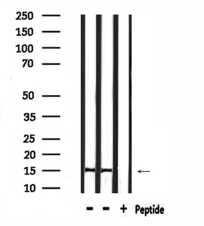 TOMM20 Antibody in Western Blot (WB)