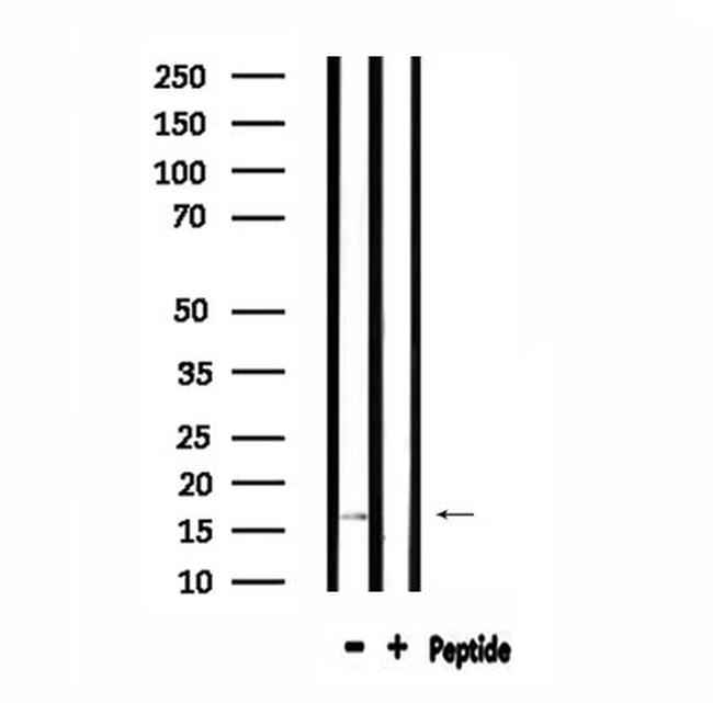 TOMM20 Antibody in Western Blot (WB)