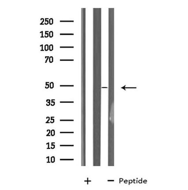 MAZ Antibody in Western Blot (WB)