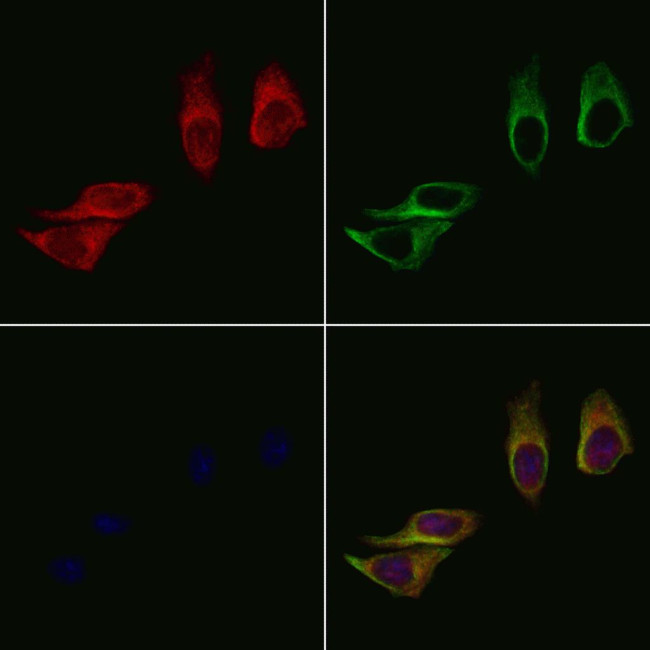 ME1 Antibody in Immunocytochemistry (ICC/IF)