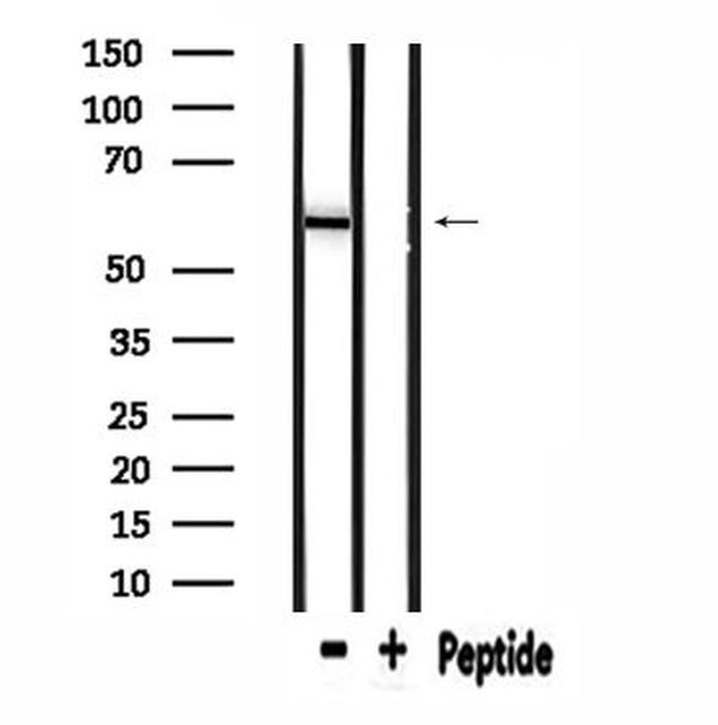 ME1 Antibody in Western Blot (WB)